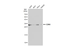Invitrogen CDK4 Polyclonal Antibody 100 μL; Unconjugated:Antibodies,