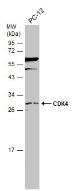 Invitrogen CDK4 Polyclonal Antibody 100 μL; Unconjugated:Antibodies,