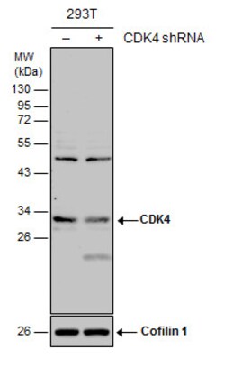 Invitrogen CDK4 Polyclonal Antibody 100 μL; Unconjugated:Antibodies,
