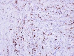 Invitrogen Collagen III Polyclonal Antibody 100 &mu;L; Unconjugated:Antibodies,