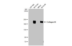 Invitrogen Collagen III Polyclonal Antibody 100 &mu;L; Unconjugated:Antibodies,