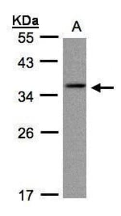 Invitrogen CRYGC Polyclonal Antibody 100 &mu;L; Unconjugated:Antibodies,