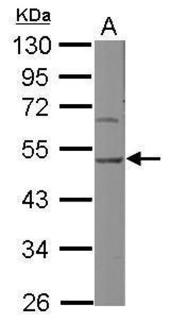 Invitrogen SERPINH1 Polyclonal Antibody 100 &mu;L; Unconjugated:Antibodies,
