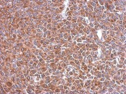 Invitrogen STIP1 Polyclonal Antibody 100 &mu;L; Unconjugated:Antibodies,