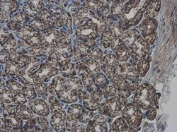 Invitrogen GLMN Polyclonal Antibody 100 &mu;L | Buy Online | Invitrogen&trade; | Fisher Scientific