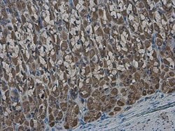 Invitrogen GLMN Polyclonal Antibody 100 &mu;L | Buy Online | Invitrogen&trade; | Fisher Scientific