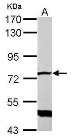 Invitrogen GLMN Polyclonal Antibody 100 &mu;L | Buy Online | Invitrogen&trade; | Fisher Scientific