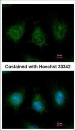 Invitrogen DAK Polyclonal Antibody 100 &mu;L; Unconjugated:Antibodies,