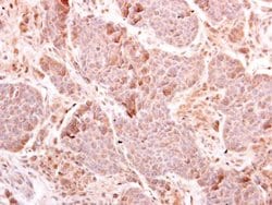 Invitrogen MDA5 Polyclonal Antibody 100 &mu;L; Unconjugated:Antibodies,