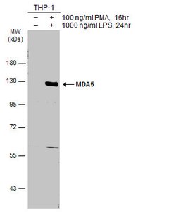 Invitrogen MDA5 Polyclonal Antibody 100 &mu;L; Unconjugated:Antibodies,