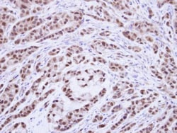 Invitrogen XPA Polyclonal Antibody 100 &mu;L; Unconjugated:Antibodies,