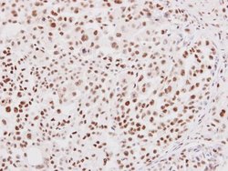 Invitrogen NRF1 Polyclonal Antibody 100 &mu;L; Unconjugated:Antibodies,