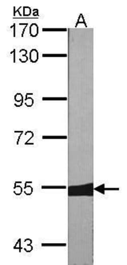 Invitrogen MUTYH Polyclonal Antibody 100 &mu;L; Unconjugated:Antibodies,