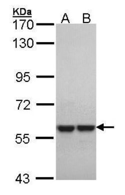 Invitrogen MUTYH Polyclonal Antibody 100 &mu;L; Unconjugated:Antibodies,
