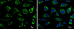 Invitrogen RRM2 Polyclonal Antibody 100 &mu;L; Unconjugated:Antibodies,