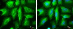 Invitrogen RRM2 Polyclonal Antibody 100 &mu;L; Unconjugated:Antibodies,