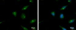 Invitrogen&trade;&nbsp;SERPINB2 Polyclonal Antibody
