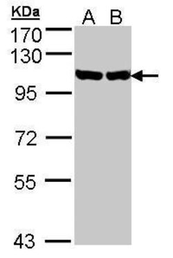 Invitrogen GRP94 Polyclonal Antibody 100 &mu;L; Unconjugated:Antibodies,