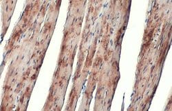 Invitrogen alpha Actinin 2 Polyclonal Antibody 100 &mu;L; Unconjugated:Antibodies,