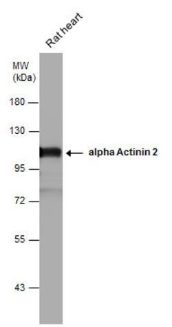 Invitrogen alpha Actinin 2 Polyclonal Antibody 100 &mu;L; Unconjugated:Antibodies,