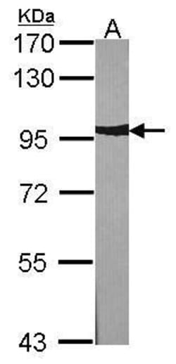 Invitrogen alpha Actinin 2 Polyclonal Antibody 100 &mu;L; Unconjugated:Antibodies,