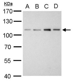 Invitrogen alpha Actinin 2 Polyclonal Antibody 100 &mu;L; Unconjugated:Antibodies,