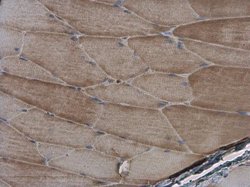 Invitrogen alpha Actinin 2 Polyclonal Antibody 100 &mu;L; Unconjugated:Antibodies,