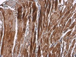 Invitrogen alpha Actinin 2 Polyclonal Antibody 100 &mu;L; Unconjugated:Antibodies,