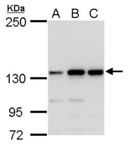 Invitrogen MSH3 Polyclonal Antibody 100 &mu;L | Buy Online | Invitrogen&trade; | Fisher Scientific