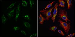 Invitrogen TFAM Polyclonal Antibody 100 &mu;L; Unconjugated:Antibodies,
