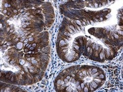 Invitrogen TFAM Polyclonal Antibody 100 &mu;L; Unconjugated:Antibodies,