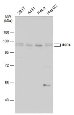 Invitrogen USP4 Polyclonal Antibody 100 &mu;L | Buy Online | Invitrogen&trade; | Fisher Scientific