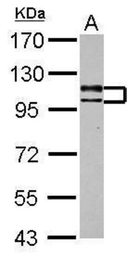 Invitrogen USP4 Polyclonal Antibody 100 &mu;L | Buy Online | Invitrogen&trade; | Fisher Scientific