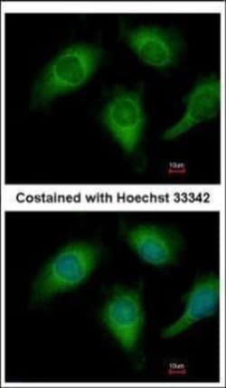 Invitrogen Annexin A4 Polyclonal Antibody 100 &mu;L; Unconjugated:Antibodies,
