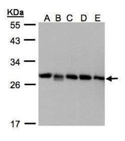 Invitrogen D4-GDI Polyclonal Antibody 100 &mu;L; Unconjugated:Antibodies,