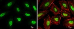 Invitrogen KLF5 Polyclonal Antibody 100 &mu;L; Unconjugated:Antibodies,