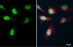 Invitrogen KLF5 Polyclonal Antibody 100 &mu;L; Unconjugated:Antibodies,