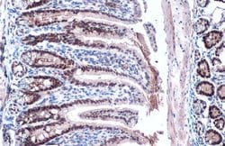 Invitrogen KLF5 Polyclonal Antibody 100 &mu;L; Unconjugated:Antibodies,