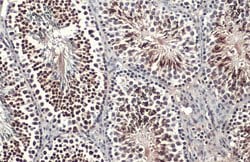 Invitrogen KLF5 Polyclonal Antibody 100 &mu;L; Unconjugated:Antibodies,