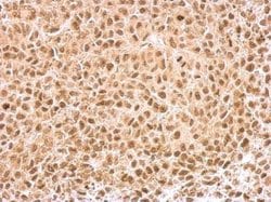 Invitrogen KLF5 Polyclonal Antibody 100 &mu;L; Unconjugated:Antibodies,