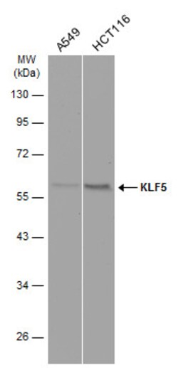 Invitrogen KLF5 Polyclonal Antibody 100 &mu;L; Unconjugated:Antibodies,