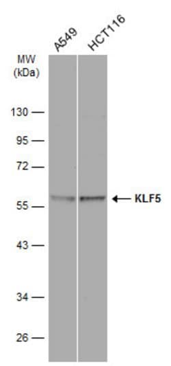 Invitrogen KLF5 Polyclonal Antibody 100 &mu;L; Unconjugated:Antibodies,