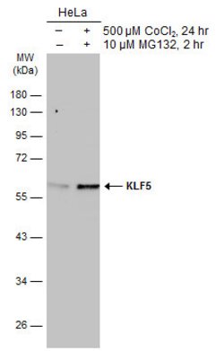 Invitrogen KLF5 Polyclonal Antibody 100 &mu;L; Unconjugated:Antibodies,