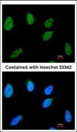 Invitrogen RAD54B Polyclonal Antibody 100 &mu;L | Buy Online | Invitrogen&trade; | Fisher Scientific