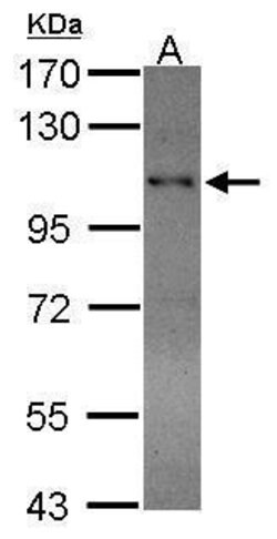 Invitrogen RAD54B Polyclonal Antibody 100 &mu;L | Buy Online | Invitrogen&trade; | Fisher Scientific