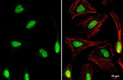 Invitrogen Nrf2 Polyclonal Antibody 100 &mu;L; Unconjugated:Antibodies,