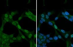Invitrogen Nrf2 Polyclonal Antibody 100 &mu;L; Unconjugated:Antibodies,