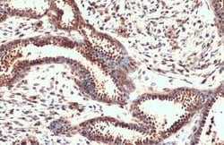 Invitrogen Nrf2 Polyclonal Antibody 100 &mu;L; Unconjugated:Antibodies,