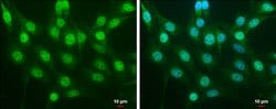 Invitrogen Nrf2 Polyclonal Antibody 100 &mu;L; Unconjugated:Antibodies,