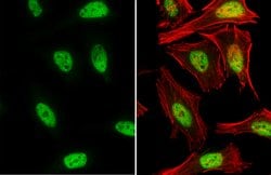 Invitrogen Nrf2 Polyclonal Antibody 100 &mu;L; Unconjugated:Antibodies,